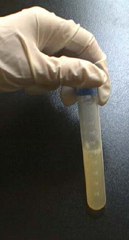 精子試験管